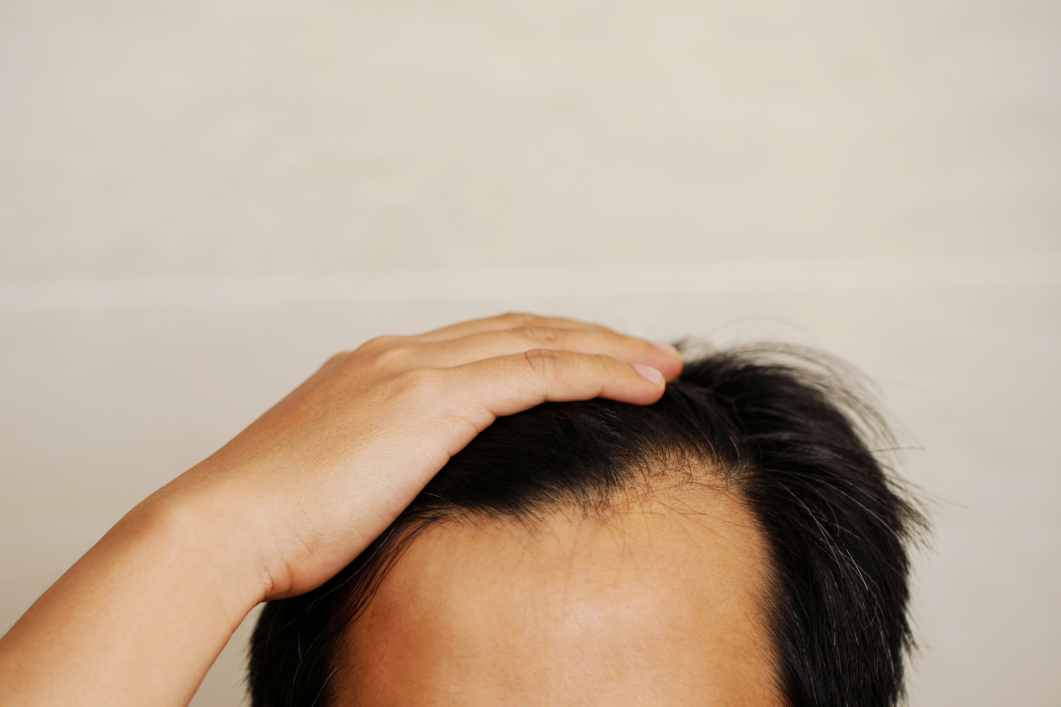 Hair Loss Treatments: Nutritional Supplement ‘vs’ Pharmaceutical Drug