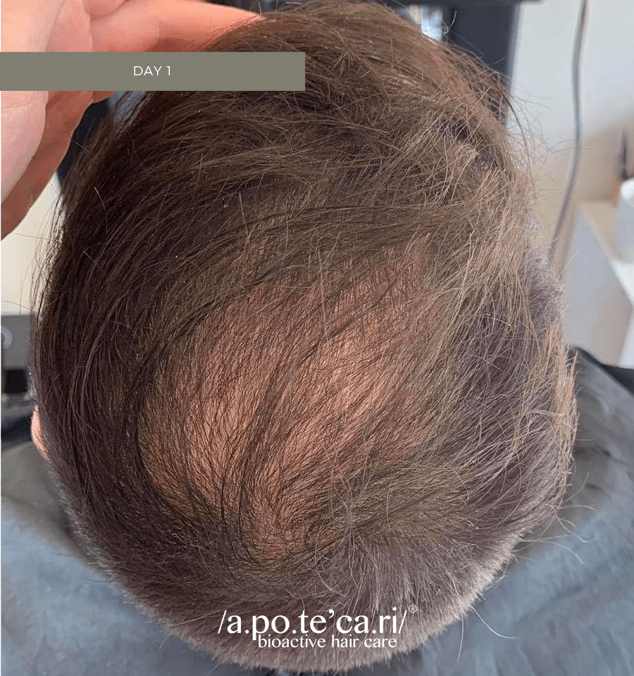 Apotecari for men, before