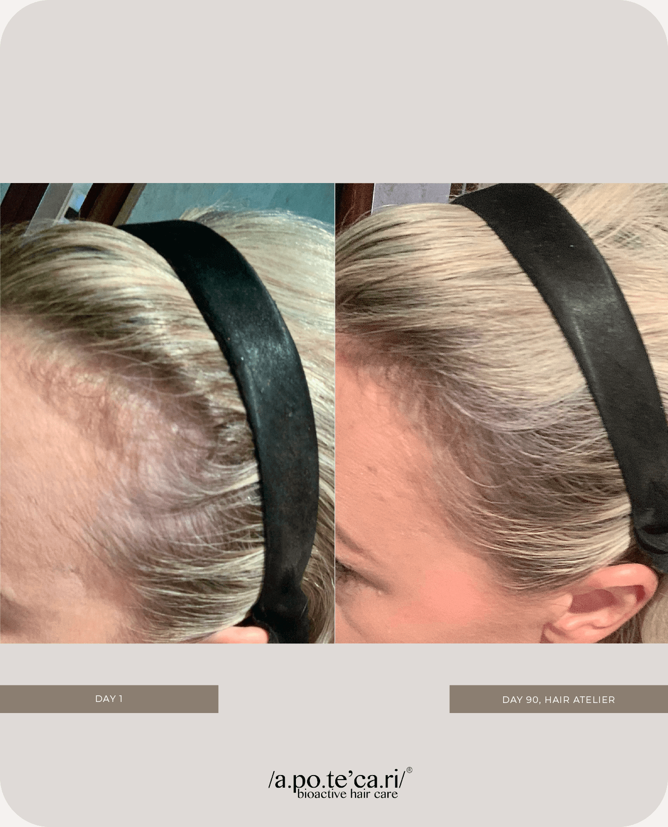 Apotecari, Hair Atelier, healthier hair, edible hair care, pomegranate, pink drink, healthy, vegan, strong hair, powder, drink, testimonial