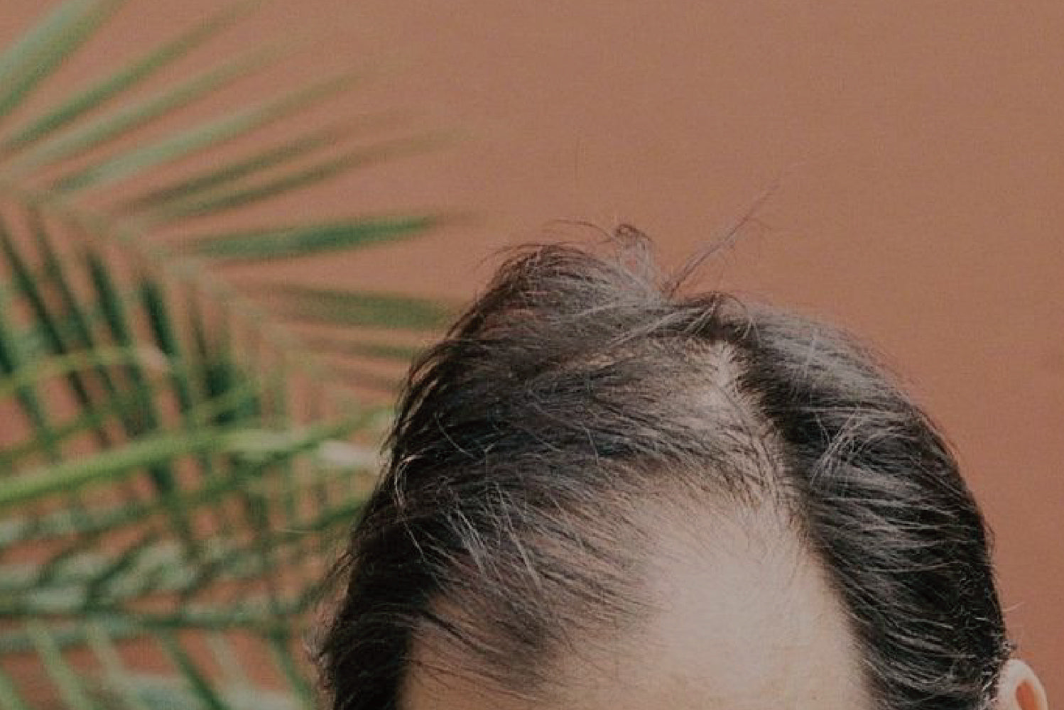 Men’s hair loss explained: Options to slow and treat