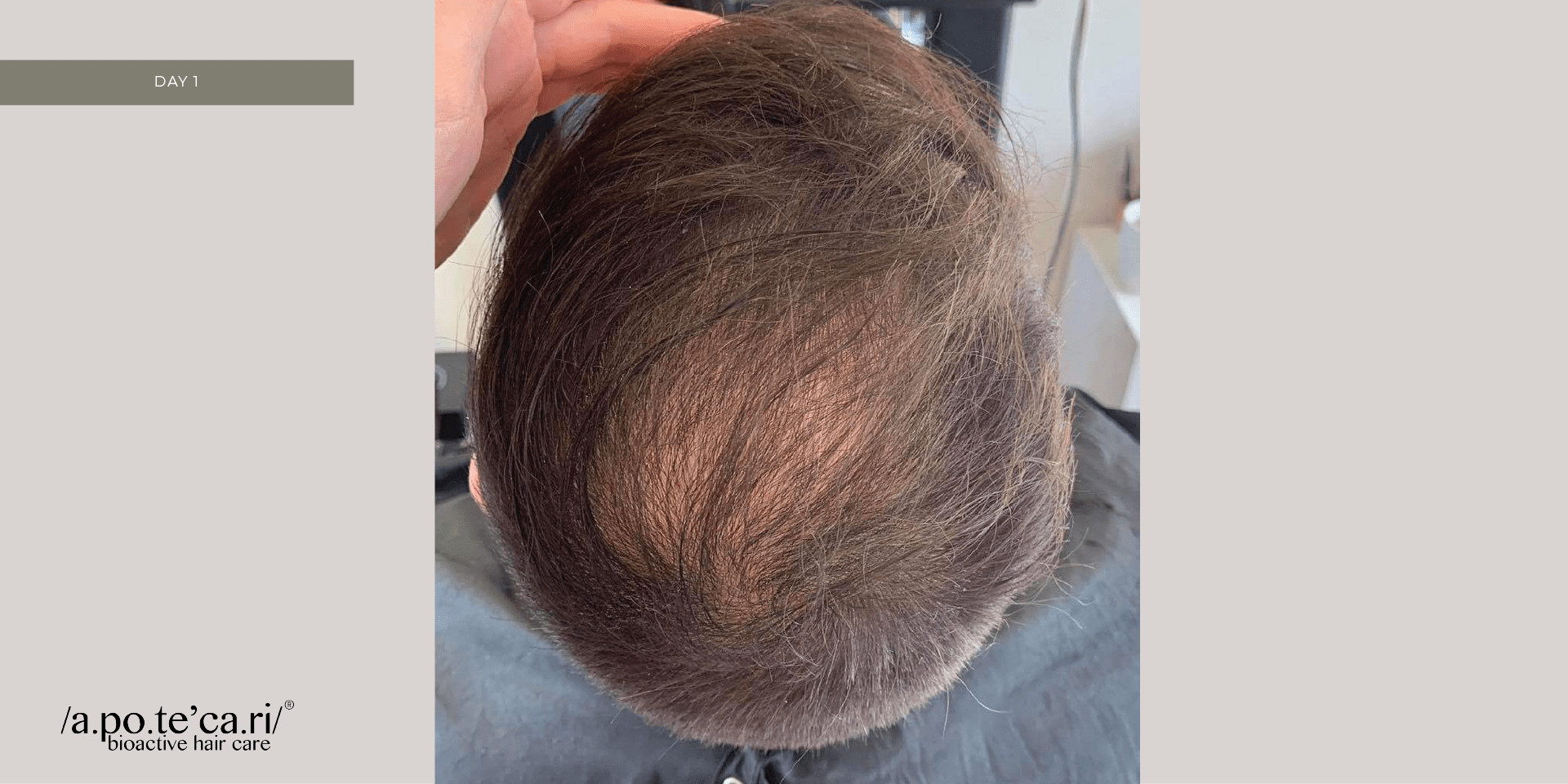 Apotecari for men, before
