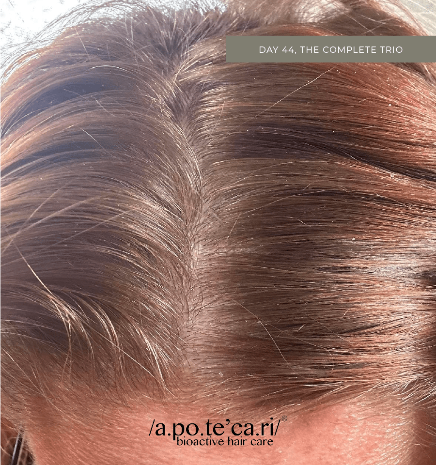 Apotecari, Crowning Glory, After, for healthy scalp