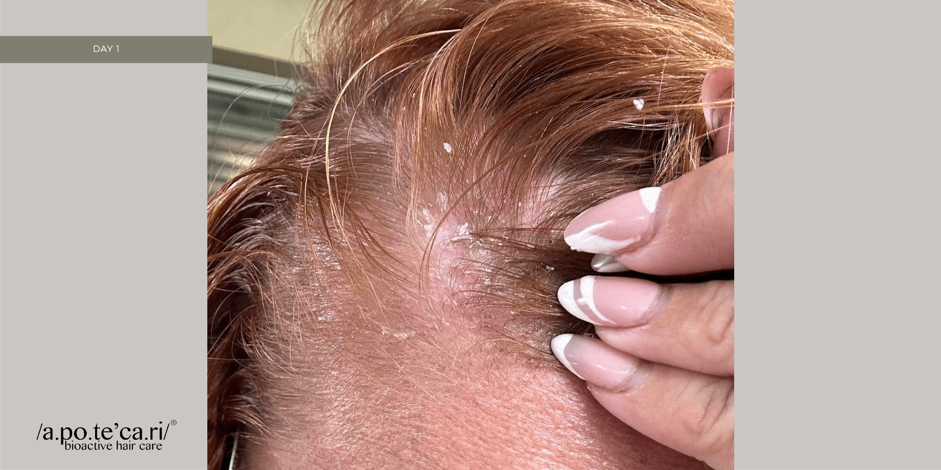 Apotecari, Crowning Glory, After, for healthy scalp