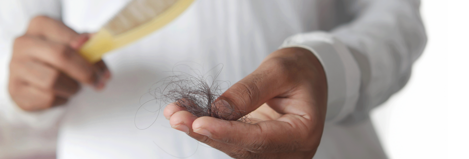 Men hair thinning