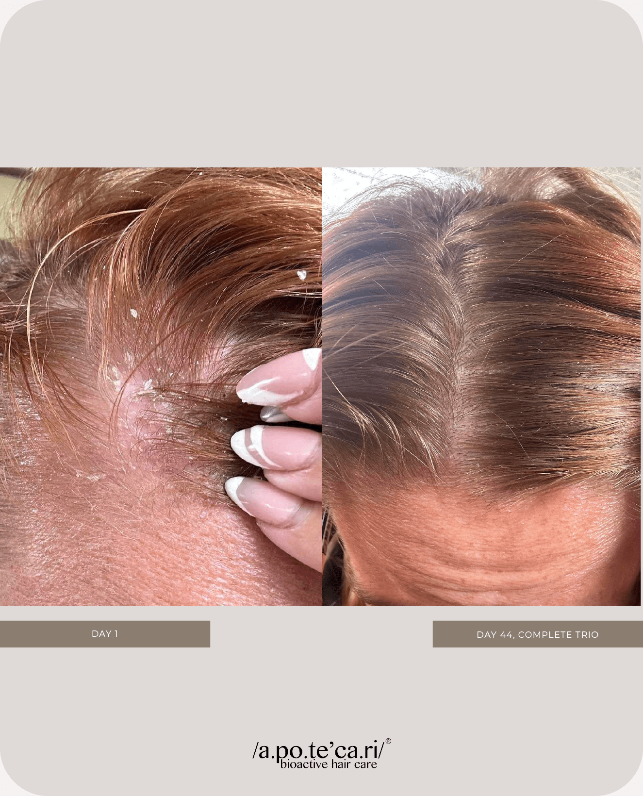 Apotecari, mane event, clowning glory, hair atelier, The complete trio, holistic, hair care, vegan, healthy hair, healthy scalp, thicker hair, testimonial, before and after, blonde, 30 days, 60 days, 90 days